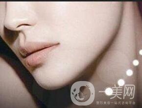 深圳墊下巴費(fèi)用一般是多少？