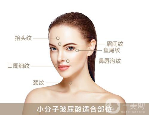 上海瑞蘭玻尿酸價(jià)格？果怎么樣？