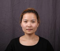 上海華美李志海下頜角整形多少錢？案例圖片實記~