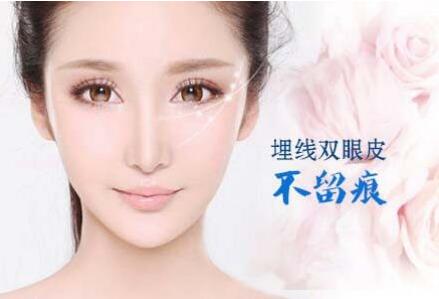 北京埋線(xiàn)雙眼皮貴嗎