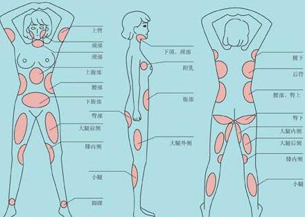 南京吸脂減肥價(jià)格是多少？