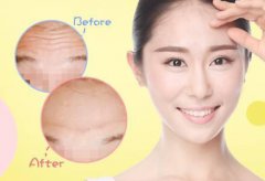 抬頭紋怎么調(diào)節(jié)？調(diào)節(jié)抬頭紋方法有哪些？