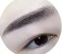 種植眉毛調節(jié)眉毛缺損手術是什么？