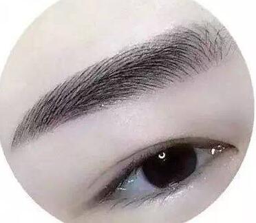 種植眉毛調(diào)節(jié)眉毛缺損手術(shù)是什么？