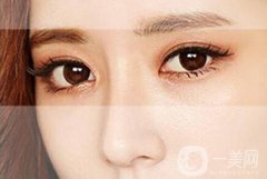 割雙眼皮的價格貴不貴？多少錢？