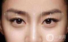 割雙眼皮大概多少錢？價格是多少？