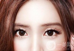 割雙眼皮價(jià)格是多少錢？收費(fèi)明細(xì)~