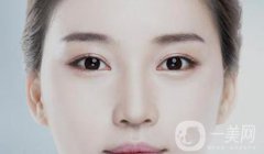 開眼角多久恢復(fù) 術(shù)后要如何護理