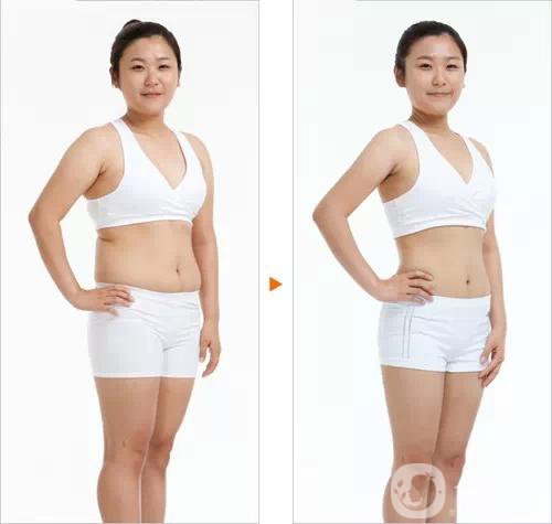 360吸脂減肥多久恢復(fù)正常?要注意些什么？