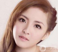 生物焊接雙眼皮價格一般是多少？