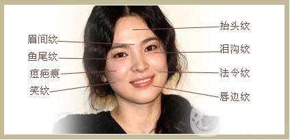 雙美膠原蛋白隆鼻怎么樣?*果能維持多久？
