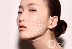 微創(chuàng)面部提升價(jià)格是多少?微創(chuàng)面部提升多少錢