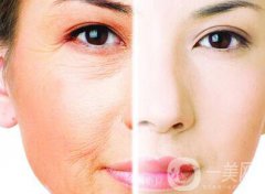 光子嫩膚的果如何、光子嫩膚到底怎么樣？