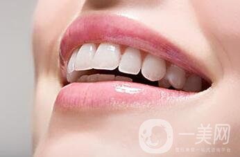 裝個(gè)烤瓷牙多少錢？烤瓷牙詳細(xì)價(jià)格介紹