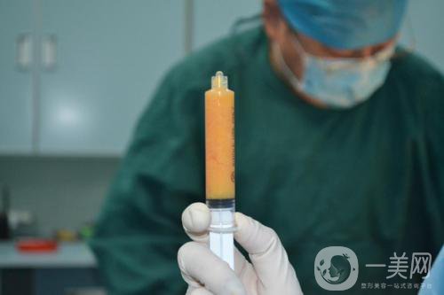 抽脂形體改良怎么做才能恢復(fù)好？