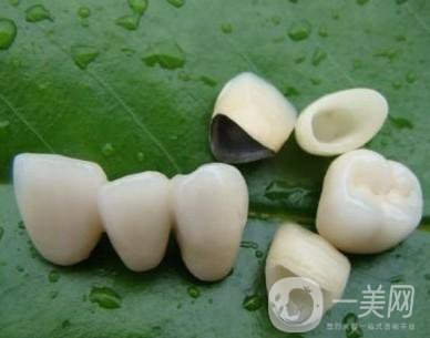 做完烤瓷牙可以使用多少年？