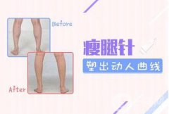 注射瘦臉的價(jià)格 注射瘦臉一般需要多少錢