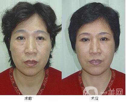*,多少錢