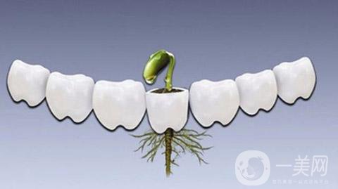 做一次種植牙的價(jià)格 費(fèi)用貴嗎？