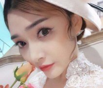 上海假體墊鼻梁多少錢 價(jià)格是多少