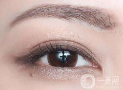 上海割雙眼皮要多少錢 上海割雙眼皮價(jià)格