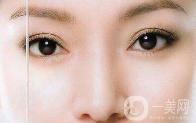 長(zhǎng)沙割雙眼皮費(fèi)用是多少？?jī)r(jià)格盤(pán)點(diǎn)