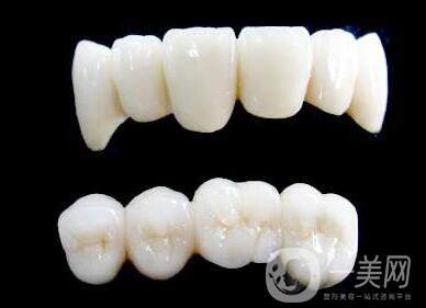 烤瓷牙能用多長(zhǎng)時(shí)間？烤瓷牙的壽命有多長(zhǎng)