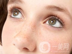 黃褐斑怎么形成的 怎么去除？