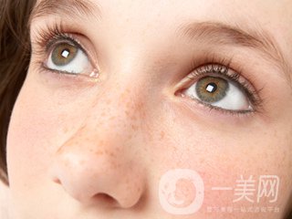 黃褐斑怎么形成的 怎么去除？
