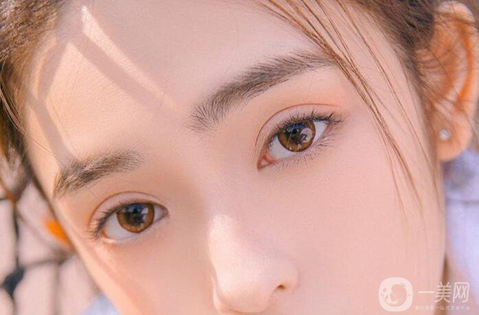 割雙眼皮,注意事項