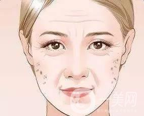為什么會長老年斑，和哪些因素有關(guān)？