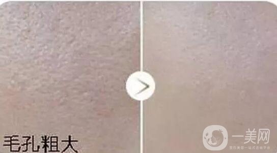 彩光嫩膚,價格