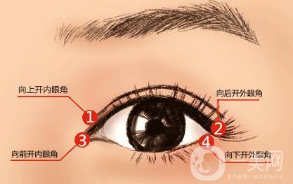 什么人適合做開眼角手術(shù)？