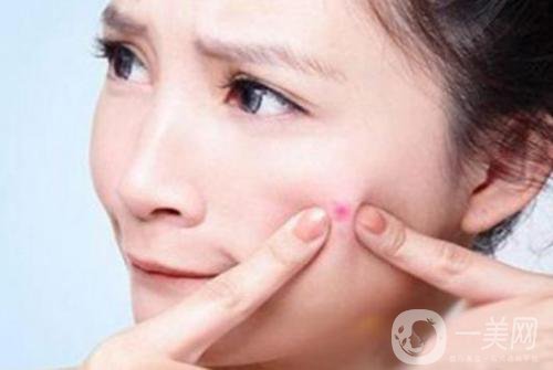 像素激光祛痘疤費(fèi)用一般要多少錢？