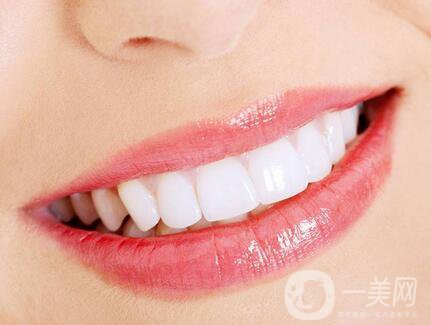 皓齒美白牙齒多少錢(qián) 皓齒美白潔牙費(fèi)用