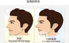 果酸換膚術(shù)做一次多少錢？