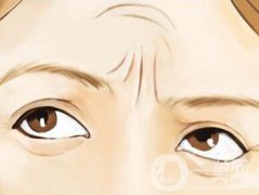 怎么去抬頭紋比較*果？