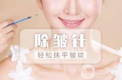 注射瘦臉生物除皺維持多久 注射瘦臉生物除皺果維持時(shí)間