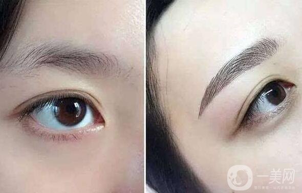 北京眉整形多少錢？?jī)r(jià)格是多少？