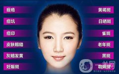 彩光嫩膚祛斑多少錢 彩光嫩膚祛斑價格介紹