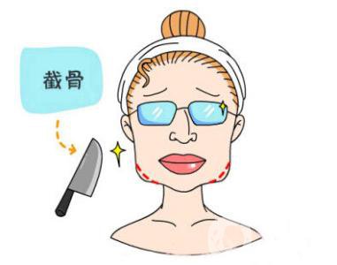 下頜角截骨手術(shù)頭套戴多久 恢復(fù)期要多久？