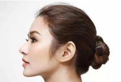 在武漢做專業(yè)隆鼻修復(fù)多少錢