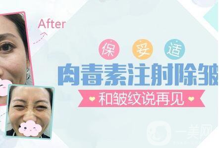 *,注射去皺,多少錢(qián)