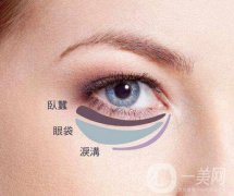 吸脂去下眼瞼眼袋怎么樣？