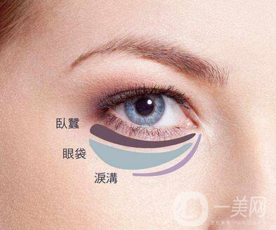 吸脂去下眼瞼眼袋怎么樣？