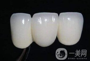貴金屬烤瓷牙的危害有哪些？