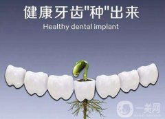 種植牙后注意事項是什么 種植牙術(shù)后護(hù)理簡介