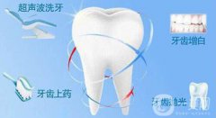 超聲波潔牙注意事項有哪些