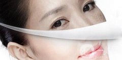 激光嫩膚果怎么樣?明星擁有白皙肌膚的秘密