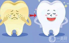 *潔牙多少錢一次?價(jià)格主要取決于那些方面?